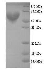Yeast neurotoxin type E protein