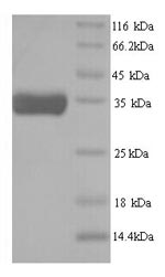 Yeast R107.2 protein