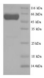 Human Human Septin-7 protein