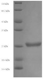 Human KIR2DS1 protein