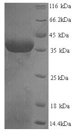 Human SART3 protein