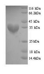 Yeast fabD protein