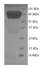 Human ATG16L1 protein