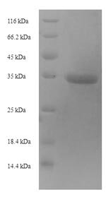 Mouse TIMP1 protein
