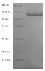 Human TUFM protein