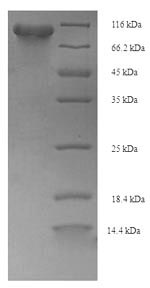 Human ppsA protein