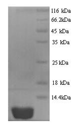 Human CXCL10 protein