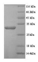 Human DSP protein