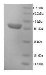 Mouse H2-D1 protein