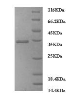 Human FCGRT protein