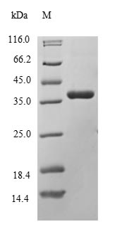 Human DLK1 protein
