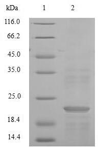 Mammal Nmes1 protein