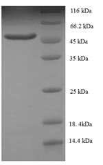 Human SMARCB1 protein
