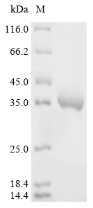 Recombinant Dendroaspis angusticeps Natriuretic peptide DNP