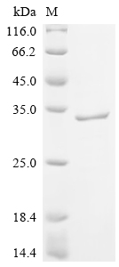 Recombinant Human Pulmonary surfactant-associated protein A1 (SFTPA1)