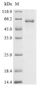 Recombinant Mouse Bile acid receptor (Nr1h4)