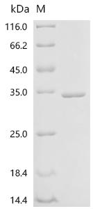 Recombinant Coxiella burnetii Chaperonin GroEL (groEL), partial