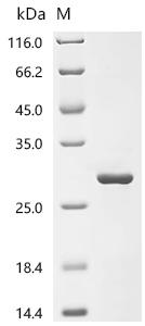 Recombinant Human Diamine acetyltransferase 1(SAT1), partial