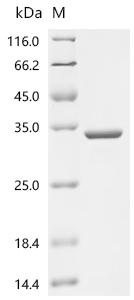 Recombinant Rabbit Beta-crystallin B2 (CRYBB2)