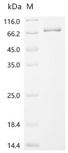 Recombinant Mouse Cyclic GMP-AMP synthase (Cgas)