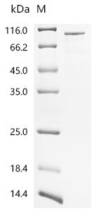Recombinant Human E3 ubiquitin-protein ligase COP1 (COP1)