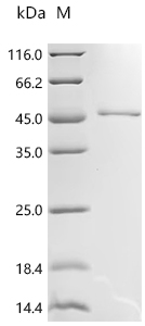 Recombinant Human Deoxyribonuclease gamma (DNASE1L3)