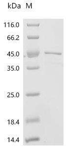 Recombinant Human Deoxyribonuclease gamma (DNASE1L3)