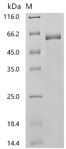 Recombinant Human E3 ubiquitin-protein ligase TRIM21 (TRIM21)