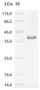 Recombinant Human Protein Wnt-3a (WNT3A), partial