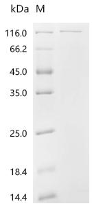 Recombinant Human Proliferation marker protein Ki-67 (MKI67), partial