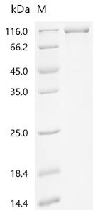 Recombinant Human Protein mono-ADP-ribosyltransferase PARP14 (PARP14), partial