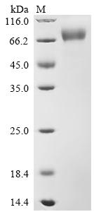 Recombinant Gibbon ape leukemia virus Envelope glycoprotein (env) , partial