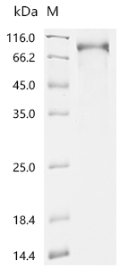 Recombinant Human Membrane cofactor protein (CD46), partial