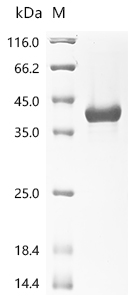 Recombinant Human High mobility group protein B1 (HMGB1), partial