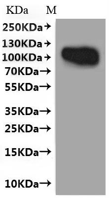 Recombinant Human T-cell surface antigen CD2 (CD2), Fluorescent-VLPs