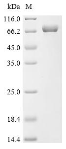 Recombinant Newcastle disease virus Hemagglutinin-neuraminidase (HN), partial