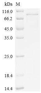 Recombinant Mouse Semaphorin-3C (Sema3c)