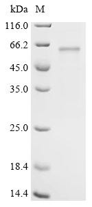 Recombinant Mouse Serine/threonine-protein kinase WNK3 (Wnk3), partial