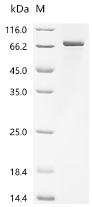 Recombinant Human Acyloxyacyl hydrolase (AOAH)