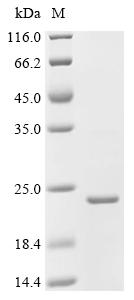 Recombinant Bacillus phage phi29 Single-stranded DNA-binding protein (5)