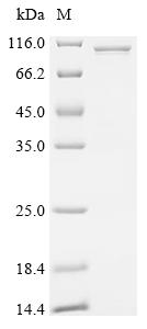 Recombinant Human Z-DNA-binding protein 1 (ZBP1), Biotinylated