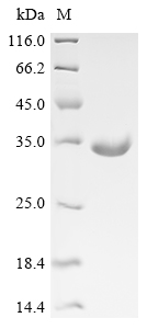 Recombinant Human Nucleolar protein 3 (NOL3)