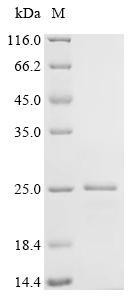 Recombinant Cricetulus griseus Uncharacterized protein