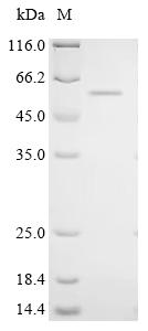 Recombinant Human Cysteine dioxygenase type 1 (CDO1)