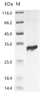 Recombinant Escherichia phage T7 T7 RNA polymerase (1), partial