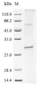 Recombinant Human CD9 antigen (CD9)
