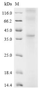 Recombinant Human Gastrin-releasing peptide receptor (GRPR)