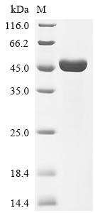Recombinant Measles virus Nucleoprotein (N), partial