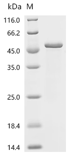 Recombinant Measles virus Nucleoprotein(N), partial