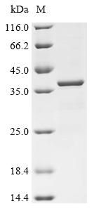 Recombinant Human Alpha-tocopherol transfer protein (TTPA)